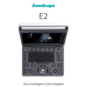 laptop-ultrasound-machine-medical-equipment-bionex-E2
