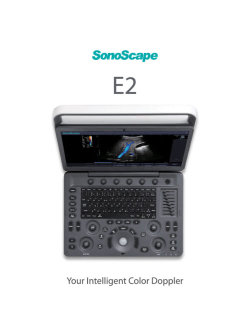 laptop-ultrasound-machine-medical-equipment-bionex-E2 laptop-ultrasound-machine-medical-equipment-bionex-E2