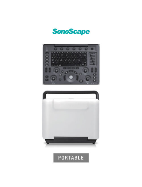 laptop-ultrasound-machine-medical-equipment-bionex-E2-portable SonoScape E2 Portable | Laptop Styled Ultrasound Machine