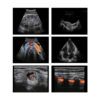 laptop-ultrasound-machine-medical-equipment-bionex-E2-portable-dubai SonoScape E2 Portable | Laptop Styled Ultrasound Machine