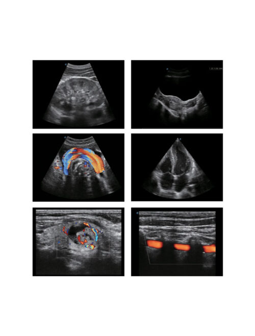 laptop-ultrasound-machine-medical-equipment-bionex-E2-portable-dubai SonoScape E2 Portable | Laptop Styled Ultrasound Machine