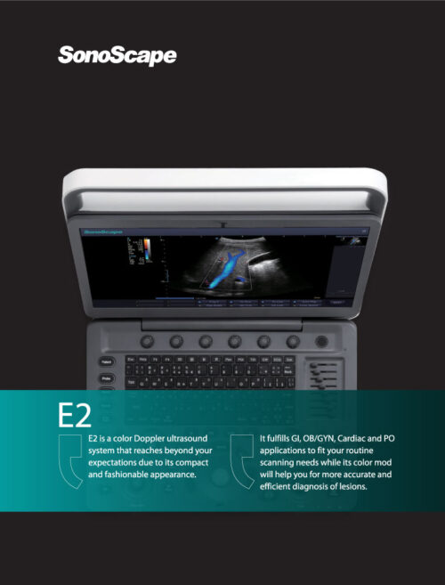 laptop-ultrasound-machine-medical-equipment-bionex-E2-portable-dubai-uae SonoScape E2 Portable | Laptop Styled Ultrasound Machine