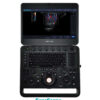 SonoScape X5 - Portable Laptop Styled Ultrasound Machine