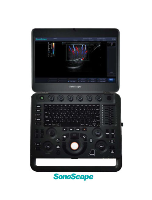 SonoScape X5 - Portable Laptop Styled Ultrasound Machine