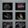 SonoScape X5 - Portable Laptop Styled Ultrasound Machine