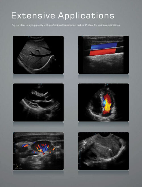 SonoScape X5 - Portable Laptop Styled Ultrasound Machine