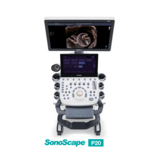 ultrasound-machine-medical-equipment