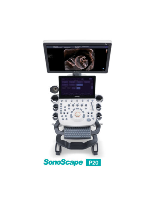 ultrasound-machine-medical-equipment