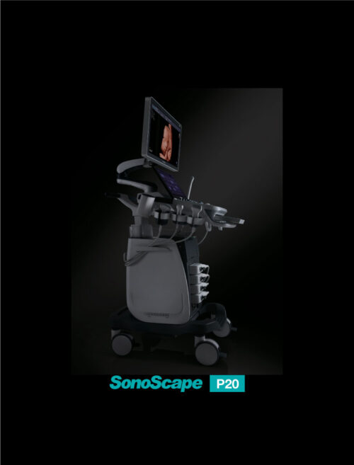 SonoScape P20 - Value & Significance