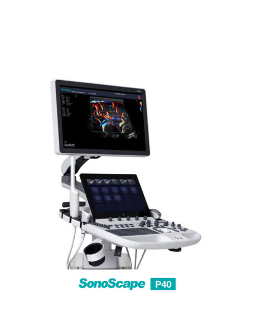 ultrasound-machine-medical-equipment-supplier-1 SonoScape P40 - Precision Perfects Performance