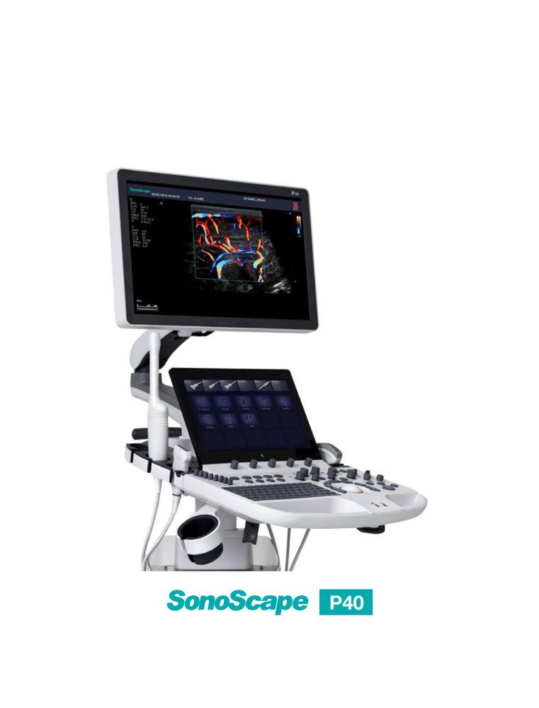 SonoScape P40 - Precision Perfects Performance - Image 2