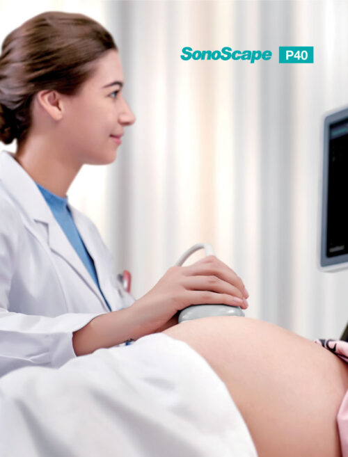 ultrasound-machine-medical-equipment-supplier-2 SonoScape P40 - Precision Perfects Performance