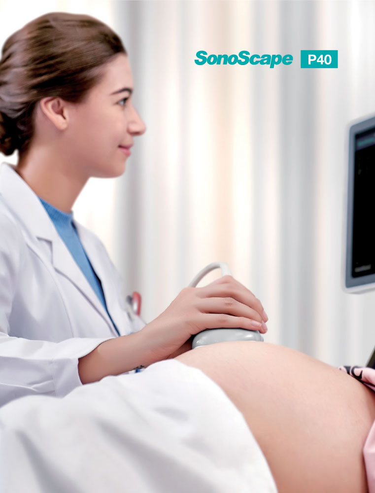 SonoScape P40 - Precision Perfects Performance - Image 3