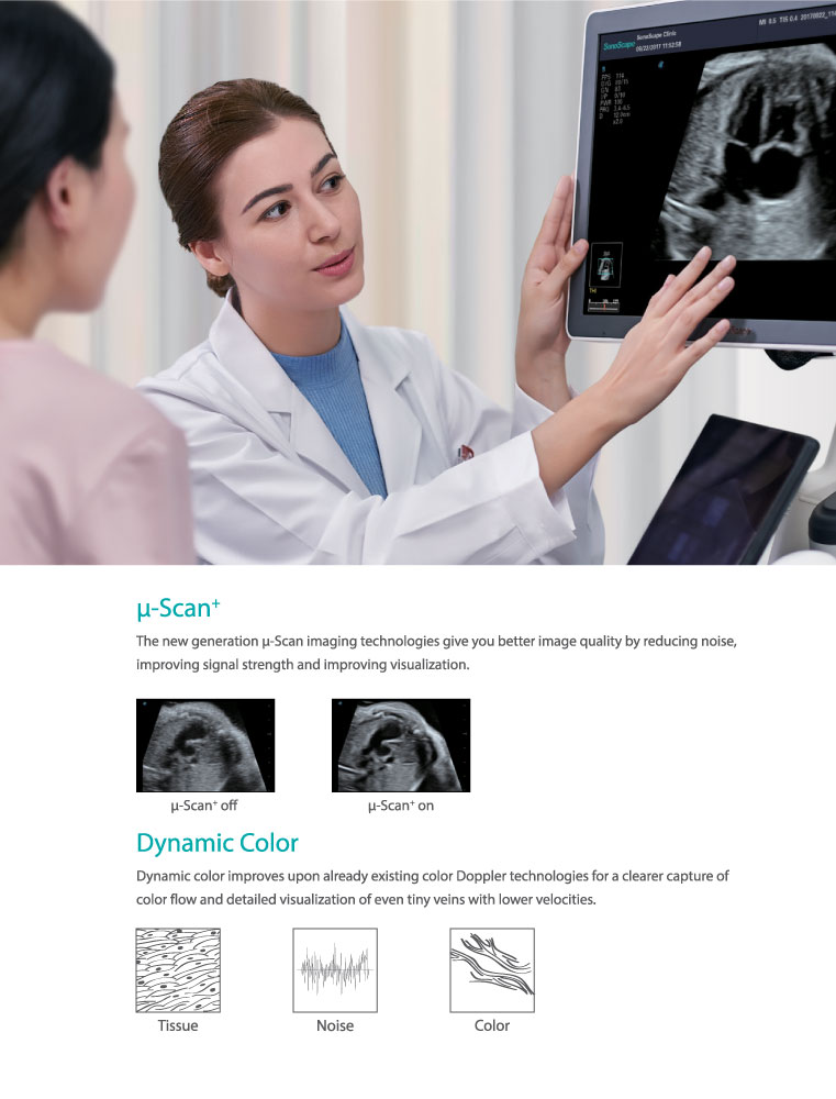 SonoScape P40 - Precision Perfects Performance - Image 4