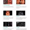 ultrasound-machine-medical-equipment-supplier-4 SonoScape P40 - Precision Perfects Performance