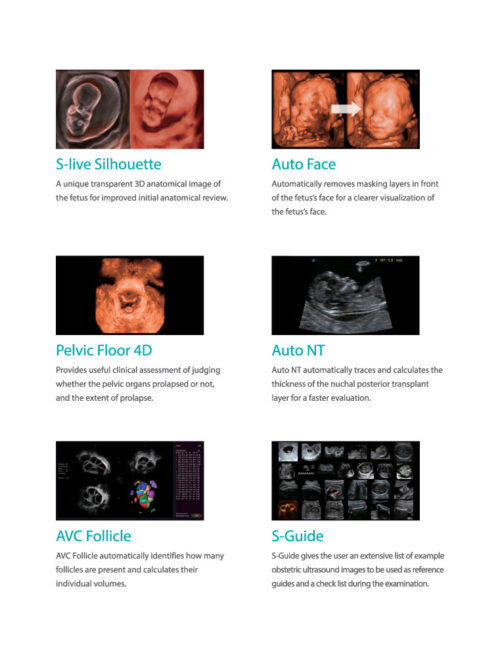 ultrasound-machine-medical-equipment-supplier-4 SonoScape P40 - Precision Perfects Performance