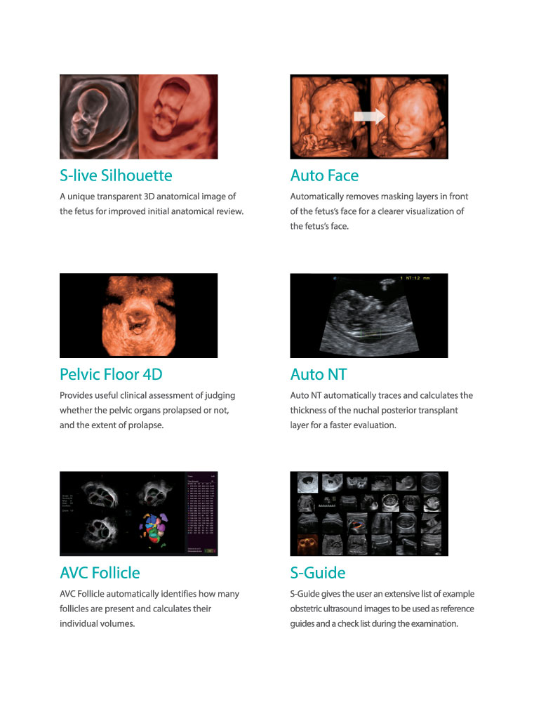 SonoScape P40 - Precision Perfects Performance - Image 5