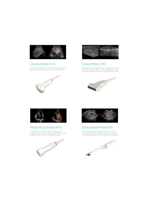 SonoScape P10 - Ultrasound Solutions with Flexibility