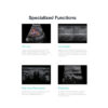 SonoScape P10 - Ultrasound Solutions with Flexibility
