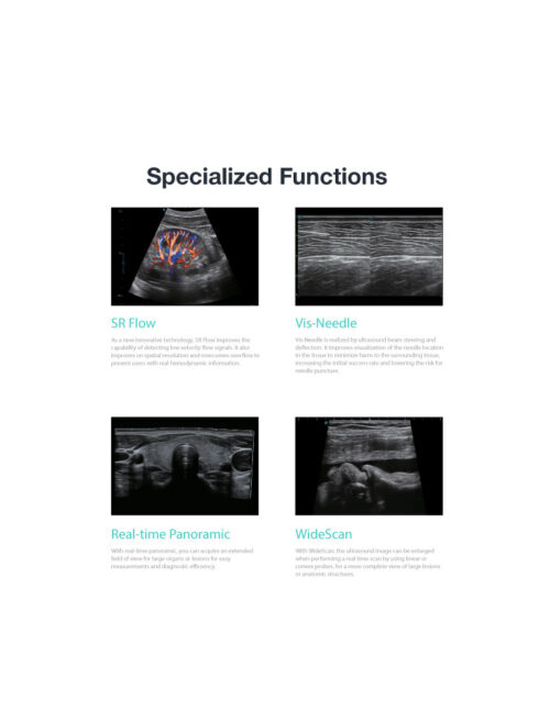 SonoScape P10 - Ultrasound Solutions with Flexibility