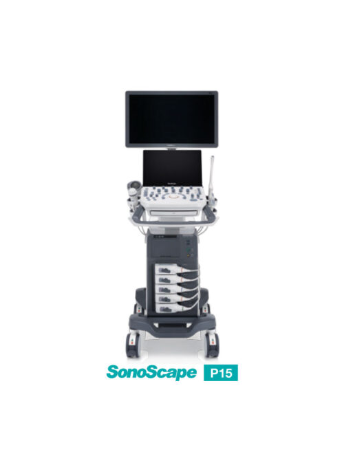 ultrasound-machine-p15-1 SonoScape P15 - Enhance Your Ultrasound Exam