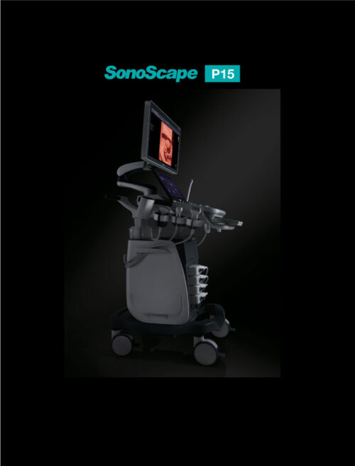ultrasound-machine-p15-2 SonoScape P15 - Enhance Your Ultrasound Exam