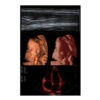 ultrasound-machine-p15-4 SonoScape P15 - Enhance Your Ultrasound Exam