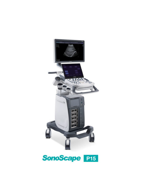 ultrasound-machine-p15 SonoScape P15 - Enhance Your Ultrasound Exam
