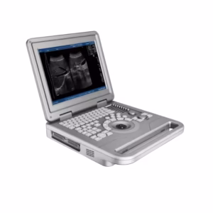 Portable Ultrasound Machine
