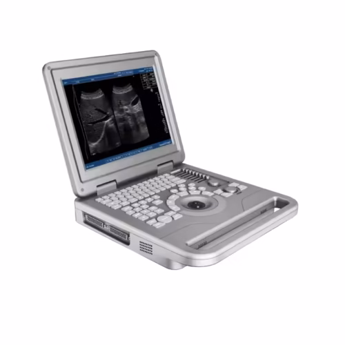 Portable Ultrasound Machine