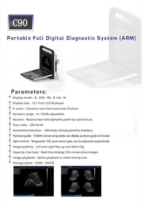 Portable Full Digital Ultrasound Machine C-90