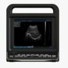 Portable Full Digital Diagnostic System