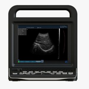 Portable Full Digital Diagnostic System