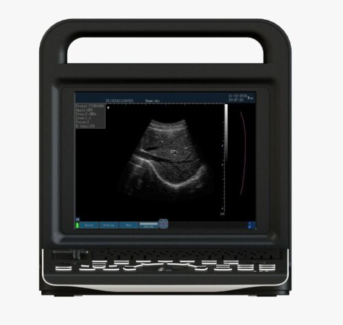Portable Full Digital Diagnostic System