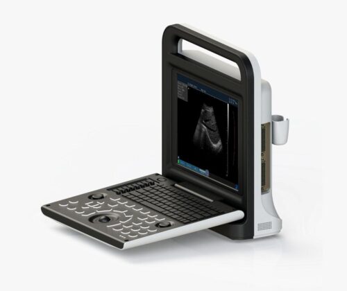 Portable Full Digital Ultrasound Machine C-90